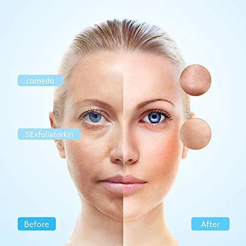 Blackhead Remover, Electric Facial Nose Pore Cleanser Acne Vacuum Suction Remover,USB Rechargeable Blackhead Silica Gel Sucker Electric Skin Cleanser Beauty Instrument
