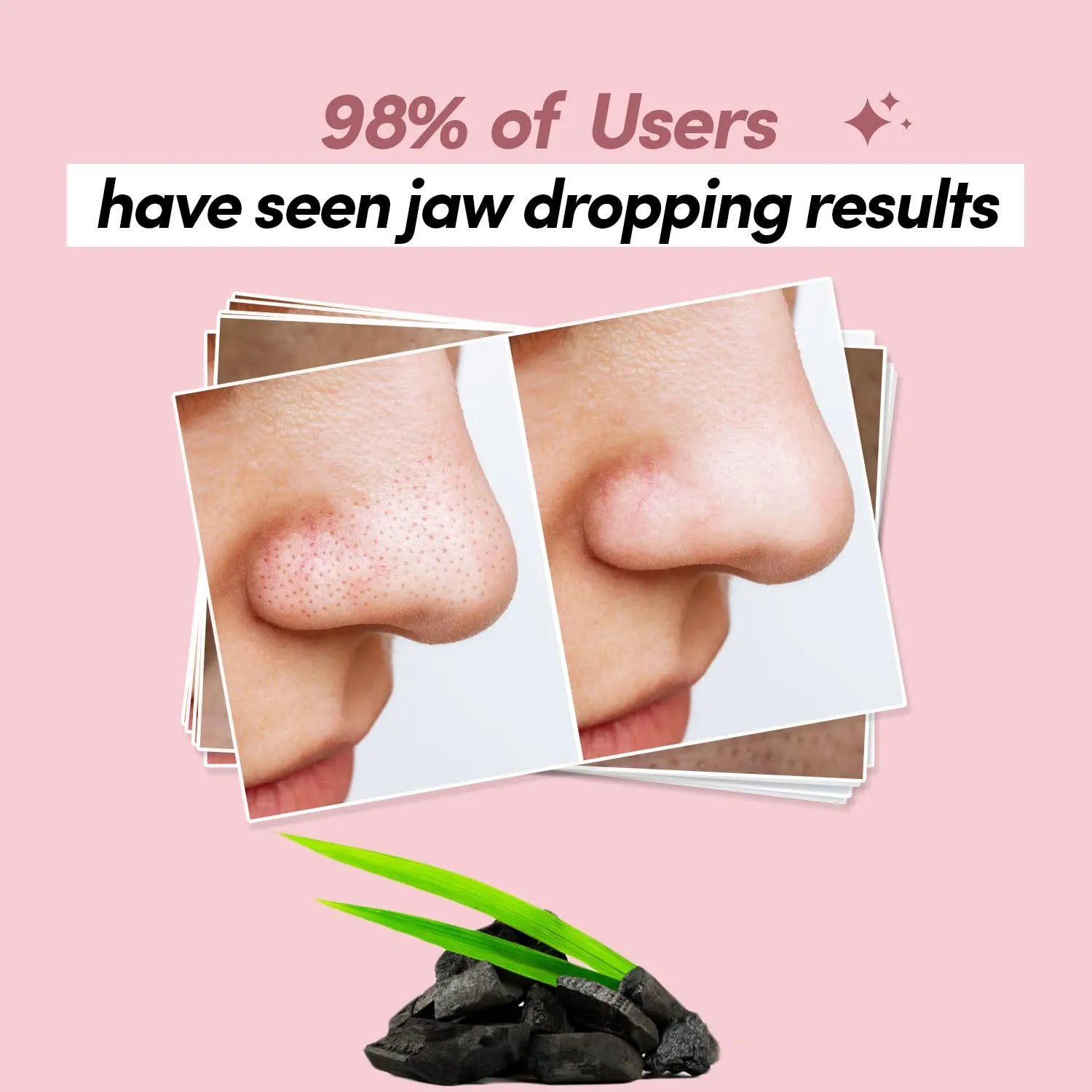 Prolixr Deep Cleansing Charcoal Nose Strips | With Witch Hazel & Tea Tree Extracts | Removes Blackheads & Whiteheads | Unclog Open Pores - For Women & Men - 6 Strips